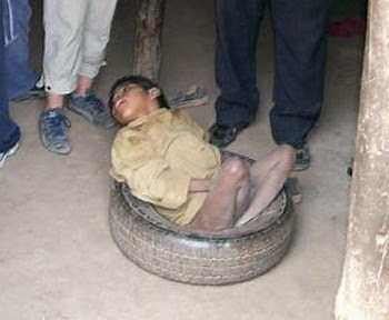 [:es]Tratamiento para 20 mil niños desnutridos se podrían adquirir con los 500 mil dolares que donó Maduro a Trump[:]