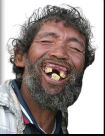 [:es]Las alternativas que aplican los venezolanos en crisis a la hora de la higiene bucal[:]