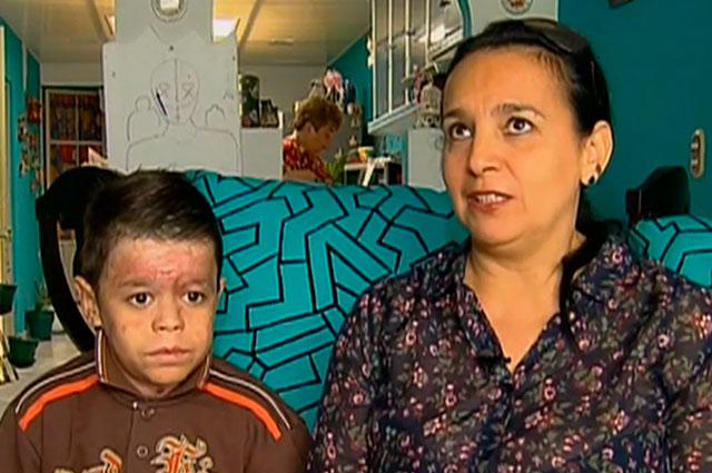 [:es]La madre de Yalik Peña, padeció también de epidermólisis bullosa[:]