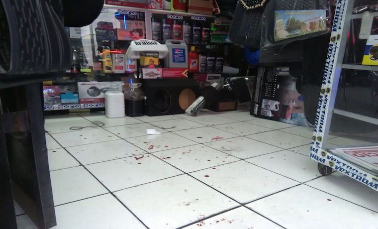 [:es]Solo porque es bonita, le desfiguraron el rostro a una venezolana en Perú[:]