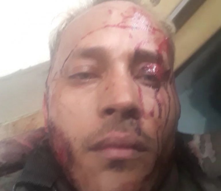 [:es]Inspector rebelde Óscar Pérez: “Nos vamos a entregar, no sigan disparando” [:]