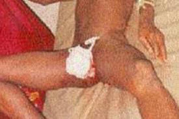 [:es]Por infiel, mujer le cortó el pene a su marido en el Día de los Enamorados[:]