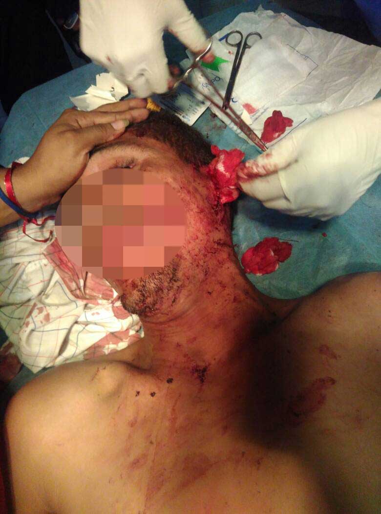 [:es]Riña callejera dejo un hombre herido en Alfallanos[:]