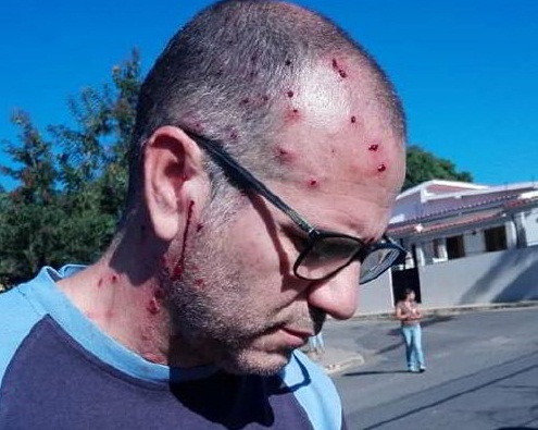 [:es]GUÁRICO. Protestaron por los pernil y llevaron fue perdigones[:]