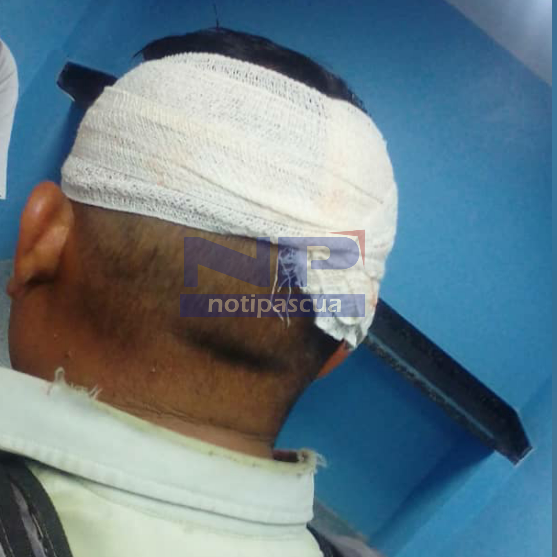 [:es]Iapatmi fue herido en protesta[:]