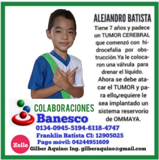 [:es]El niño Alejandro Batista necesita una mano amiga  [:]