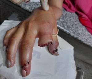 [:es]Lara: La amordazaron y le cortaron tres dedos para robarla [:]