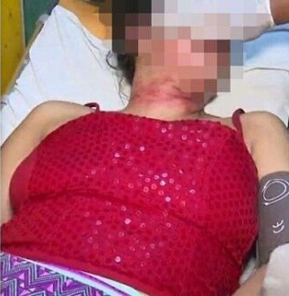 Victima de la agresión. Imagen cortesía