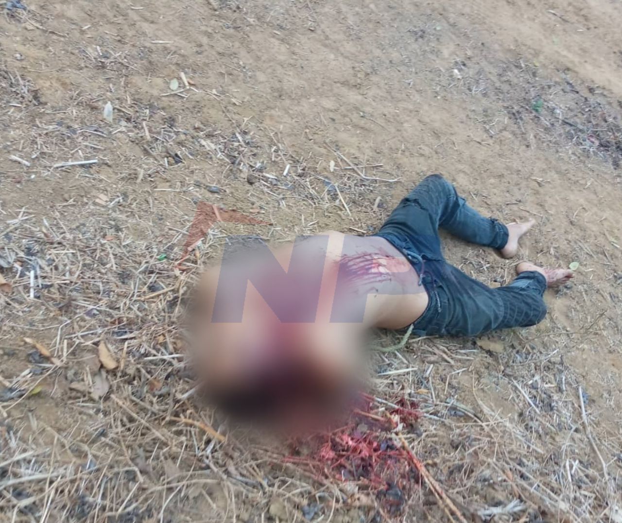 [:es]Amarrado y con heridas en la cabeza fue localizado un cuerpo en La Pascua[:]