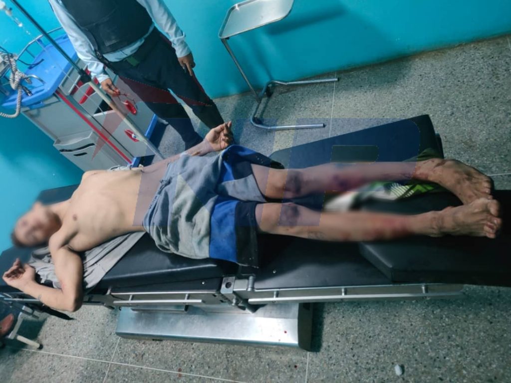 Momento que el recapturado era atendido en el hospital central de Valle de la Pascua