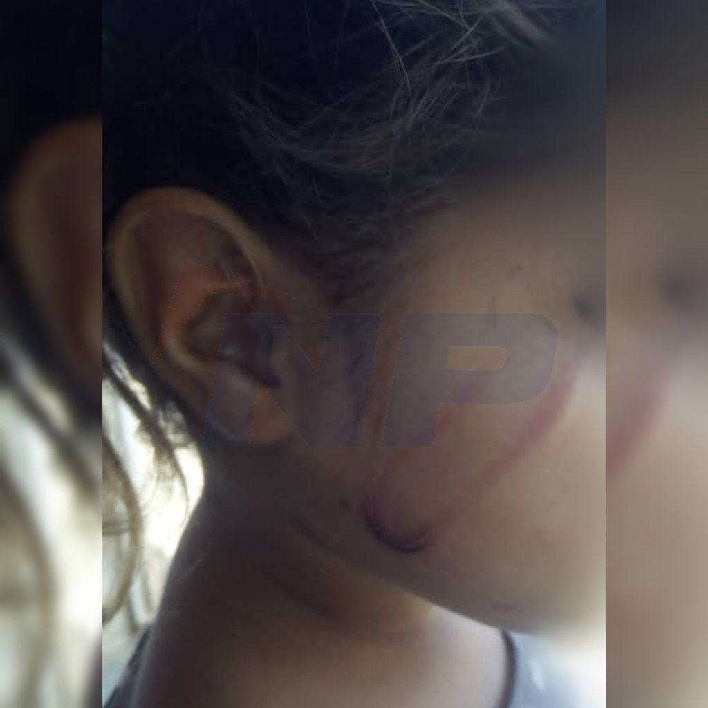 La madre golpeó con un cable el rostro de la menor. 