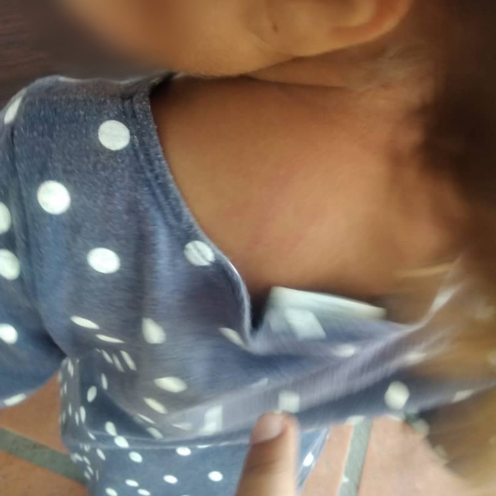 En la espalda también tiene marcas de maltrato