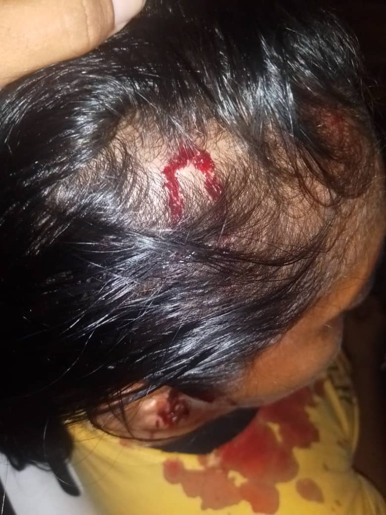 La victima resultó herida.