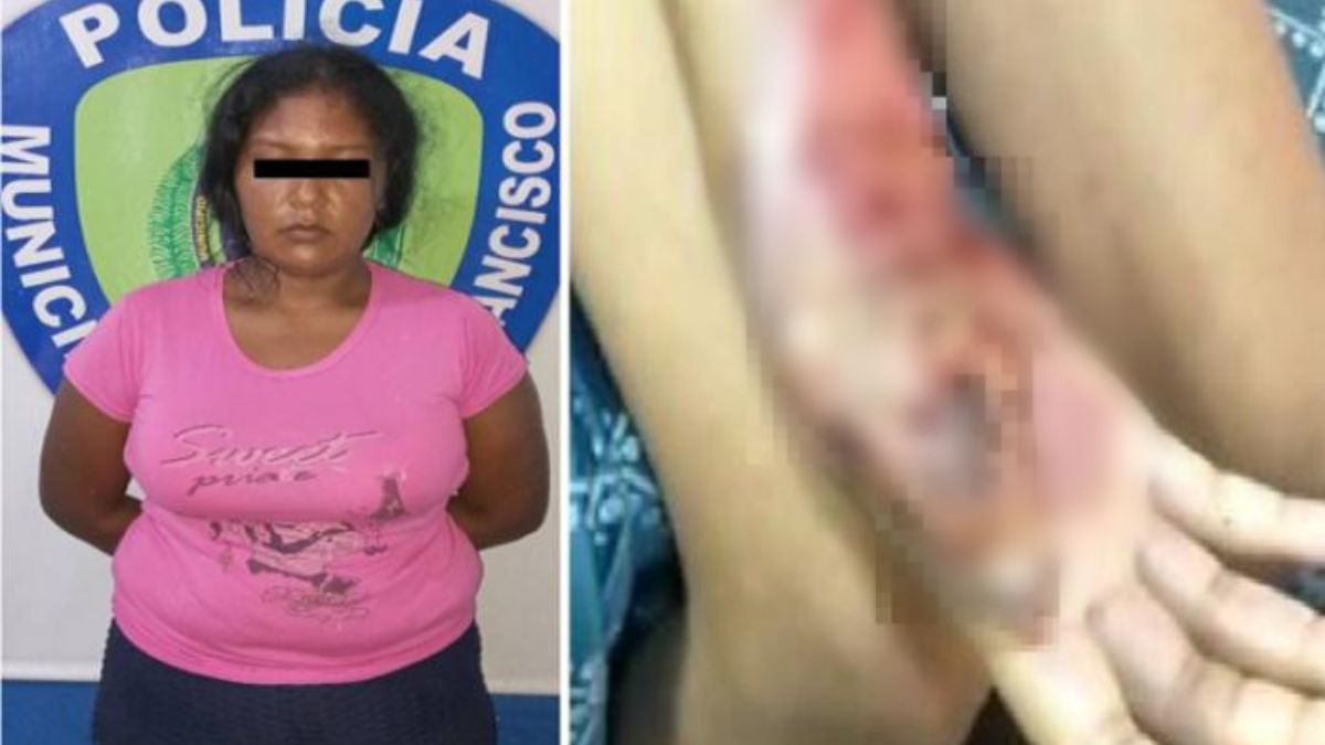 [:es]Una mujer le quemo las manos a su hija[:]