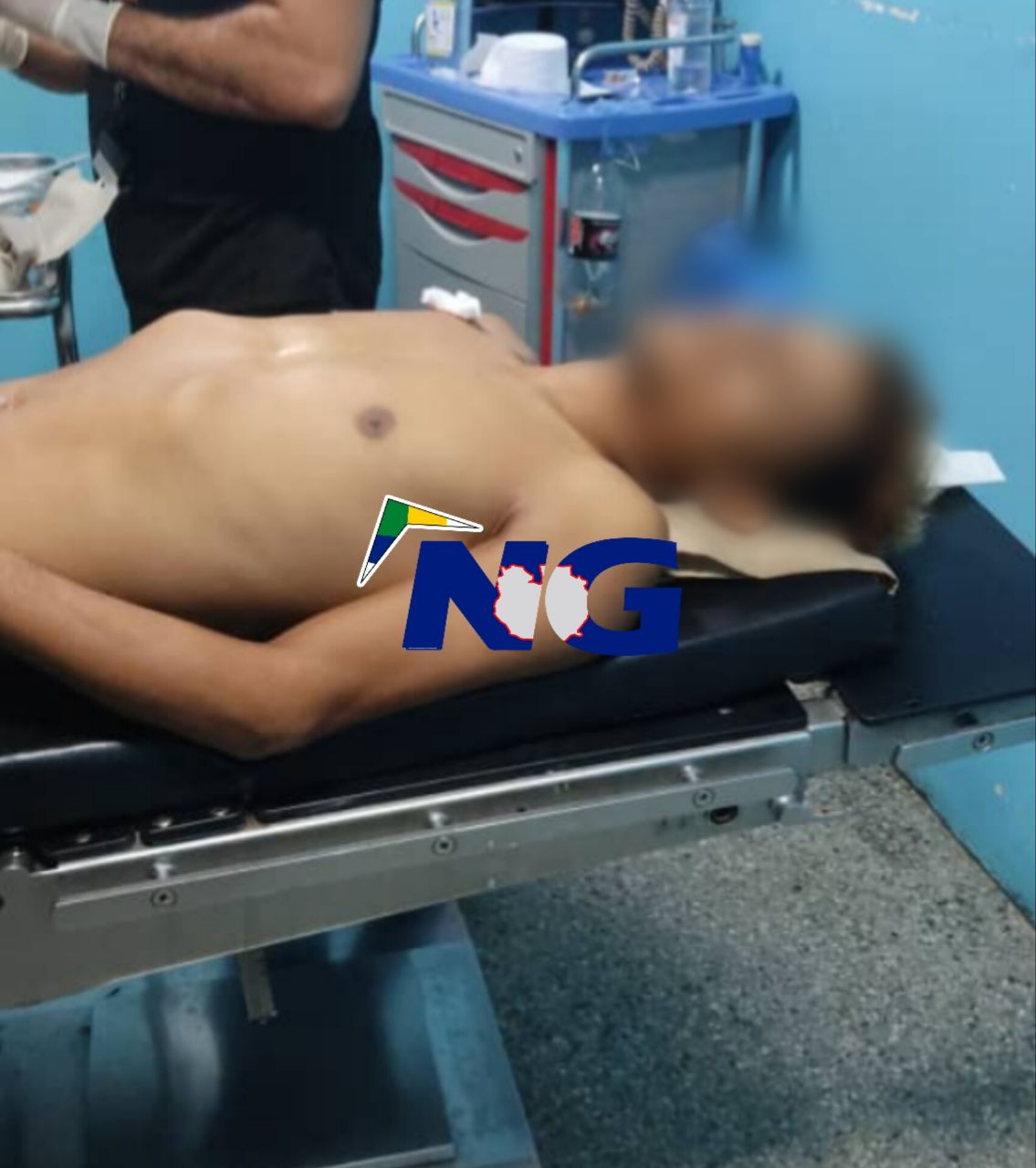 [:es]Resultó herido por una bala perdida en Las Garcitas[:]